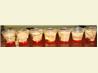 Brain Hemorrhage