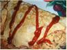 Omu Rice (Japanese Omelette)